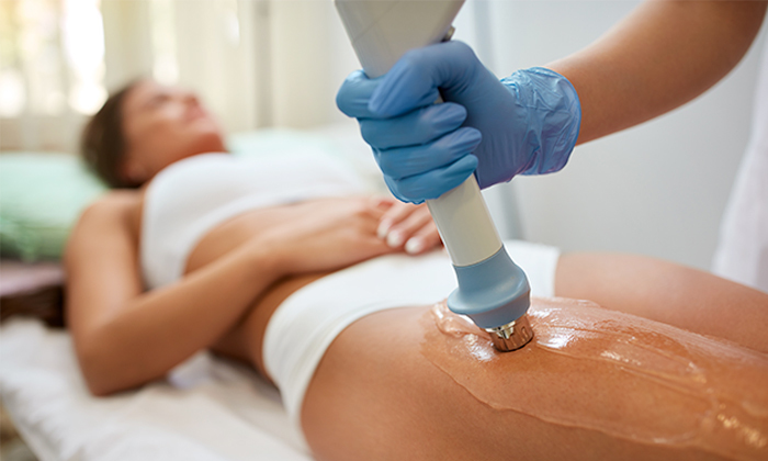 2 טיפול קוסמטי בצלוליט במכון היופי The beauty lounge, תל אביב