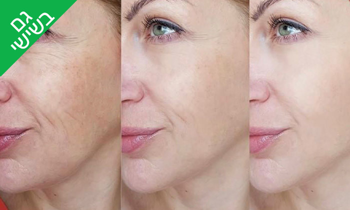 4 טיפול פנים לבחירה בקליניקת T.Beauty, רחובות - גם בשישי